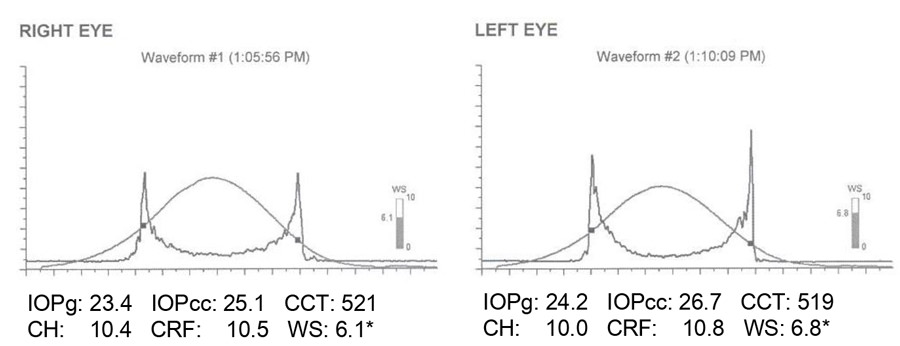 right-left-eye